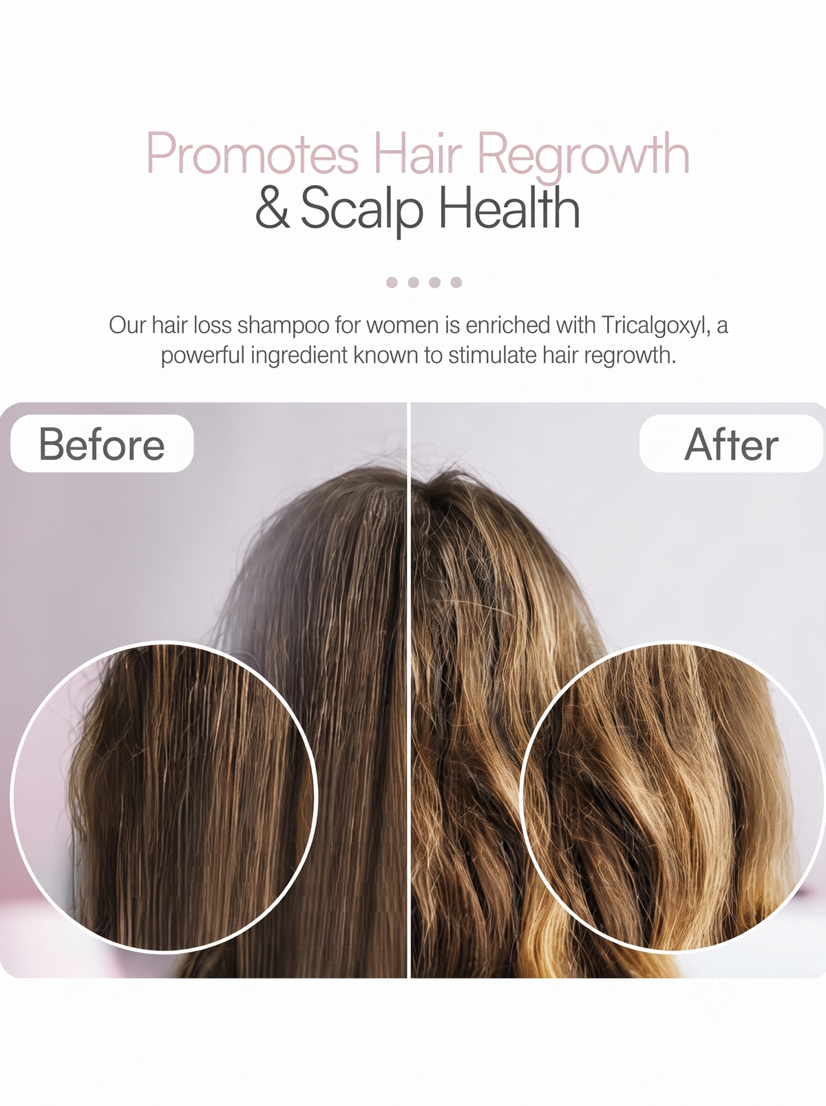 Foltene Pharma Strengthening for Thinning Hair Women Shampoo